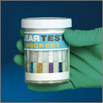 Point of Care Diagnostics for Urine/ Blood/ Saliva/ Stool