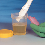Point of Care Diagnostics for Urine/ Blood/ Saliva/ Stool