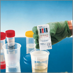 Point of Care Diagnostics for Urine/ Blood/ Saliva/ Stool